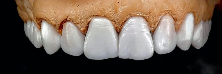 Home Encerado de diagnóstico en laboratorio dental